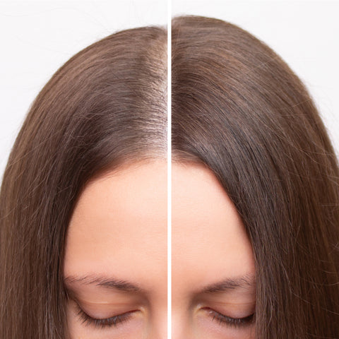 Treatment for Thinning Hair
